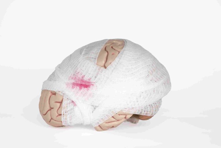 Understanding Traumatic Brain Injuries: Symptoms, Treatment, and Legal Support